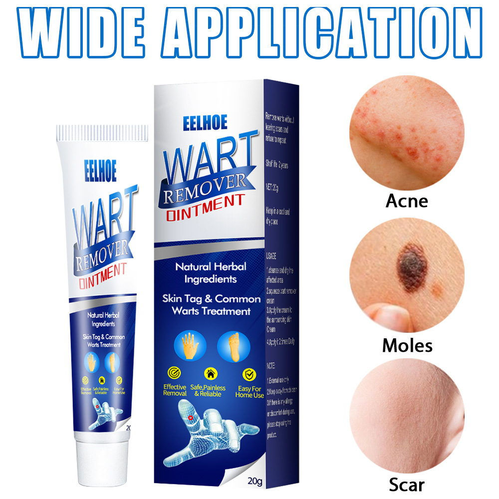 Zhongcao Keyou Liquid Skin Wart Cream – Effective Wart Removal & Skin Care - Image 6