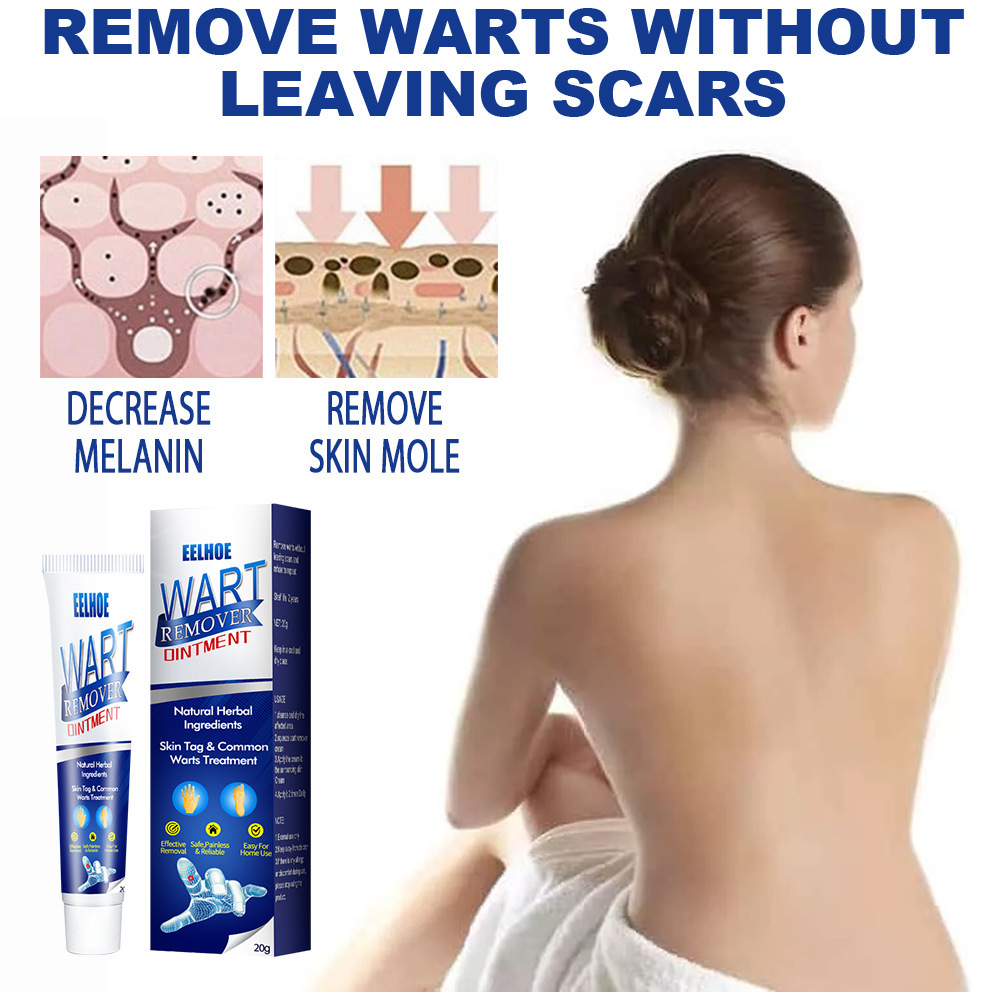 Zhongcao Keyou Liquid Skin Wart Cream – Effective Wart Removal & Skin Care - Image 4