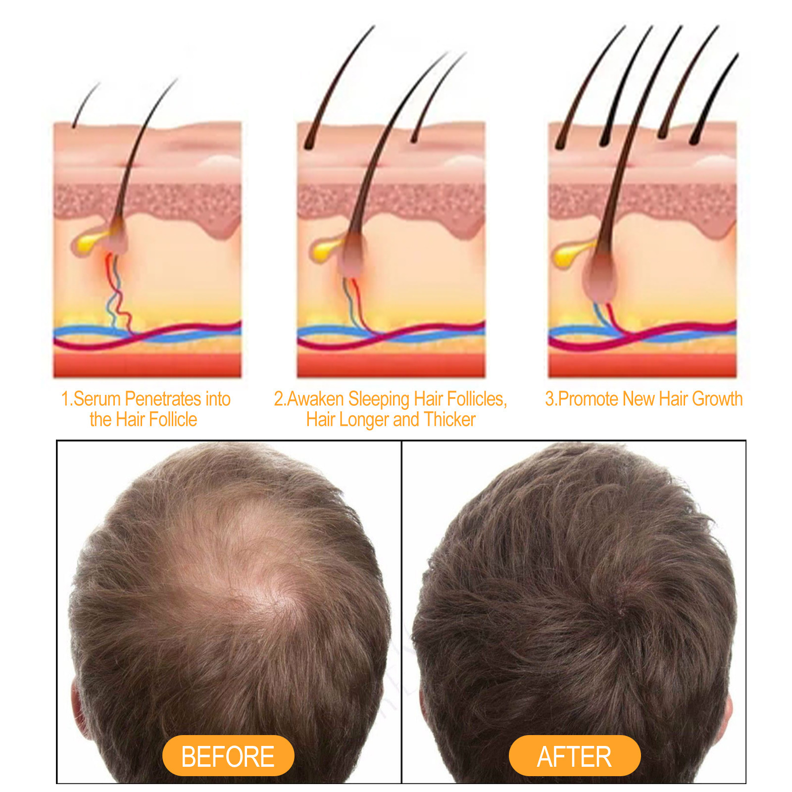 Ginger Strong Hair Nourishing Shampoo – Prevent Hair Loss & Repair Damaged Hair (100ml) - Image 4