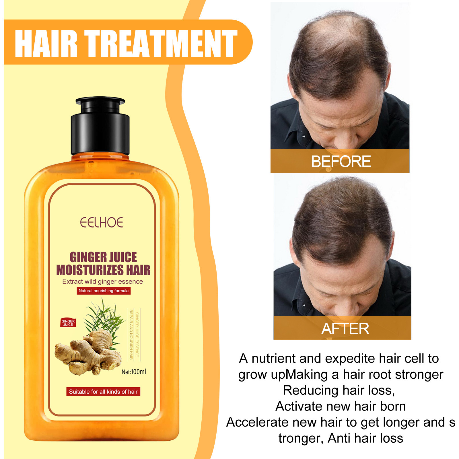 Ginger Strong Hair Nourishing Shampoo – Prevent Hair Loss & Repair Damaged Hair (100ml) - Image 5