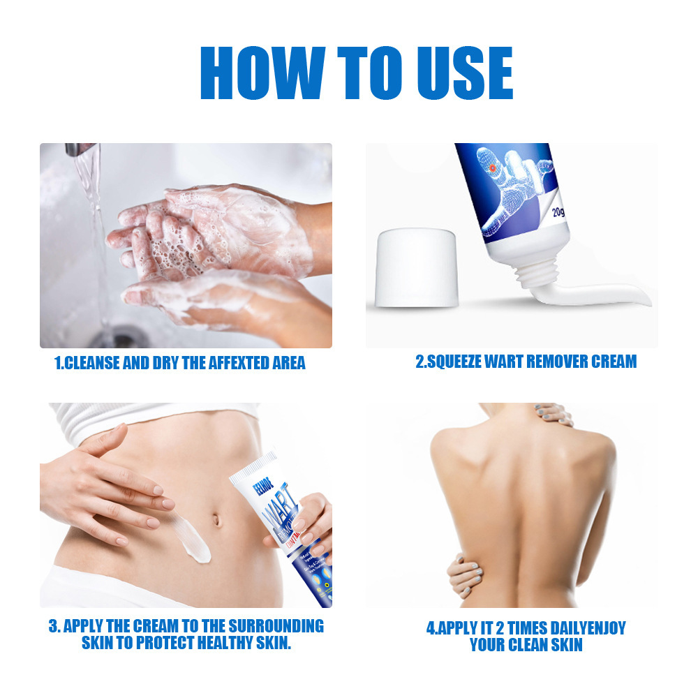 Zhongcao Keyou Liquid Skin Wart Cream – Effective Wart Removal & Skin Care - Image 2